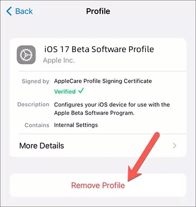 remove profile on iphone